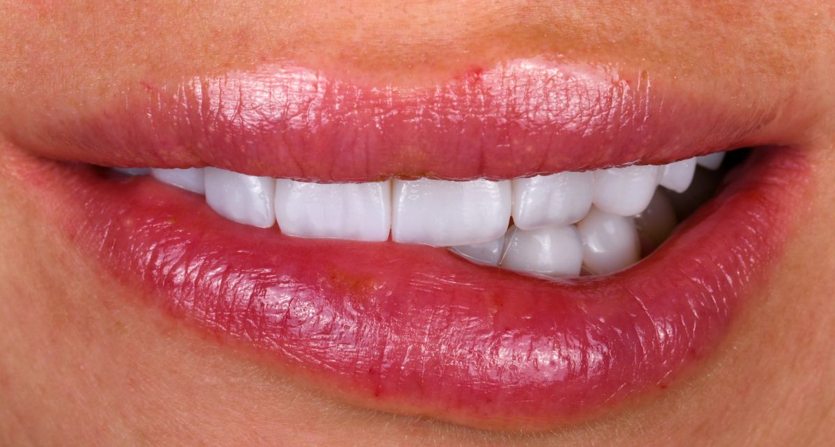 Learn about the All on 6 dental implant procedure and the advantages it offers. Explore the benefits of this innovative tooth replacement solution.