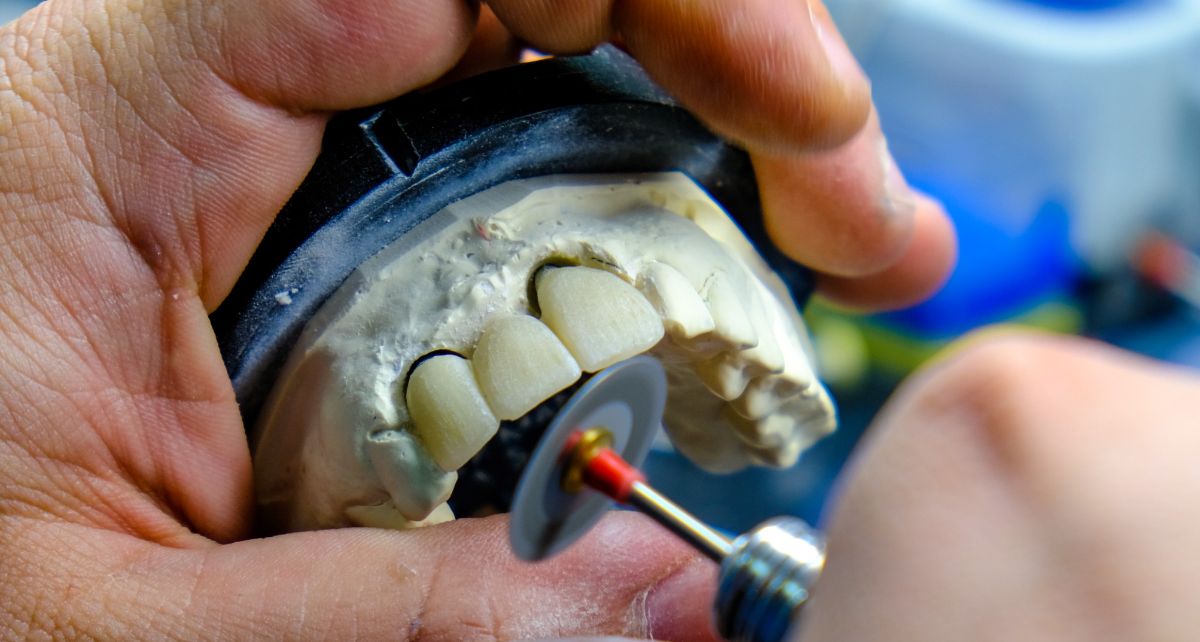 An informative image about dental crowns, covering their uses, placement, advantages, and maintenance. Explore how dental crowns can restore and protect weakened or damaged teeth for a healthier smile.