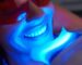 An image depicting the teeth whitening process, highlighting the benefits and potential side effects for a brighter smile.