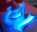 An image depicting the teeth whitening process, highlighting the benefits and potential side effects for a brighter smile.