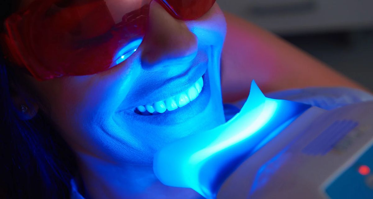 An image depicting the teeth whitening process, highlighting the benefits and potential side effects for a brighter smile.