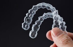 Learn about Invisalign, the clear and convenient alternative to traditional braces for achieving a perfect smile. Explore the advantages of this discreet teeth straightening treatment.