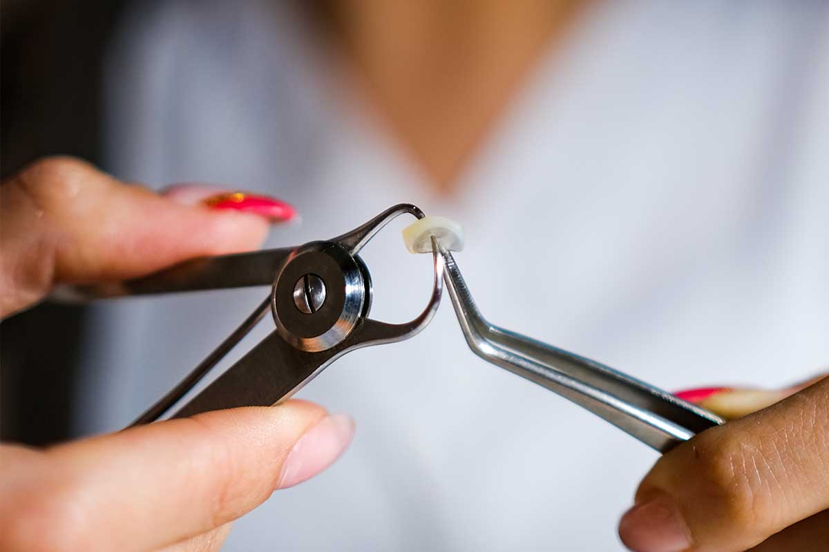 Dental Crown Materials: What's Best for You in Istanbul