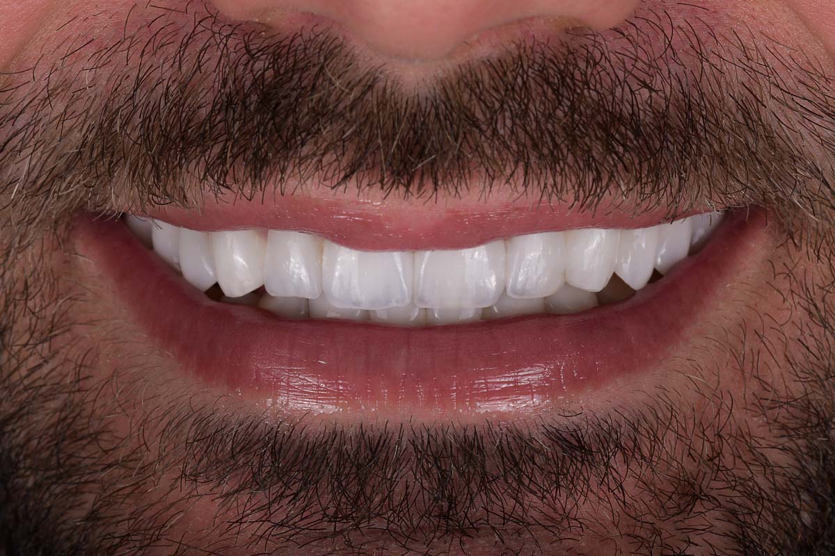 Orthodontic Treatment Can Transform Your Smile