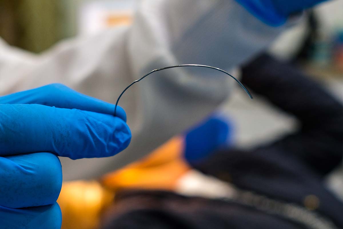 The Science Behind Orthodontic Treatment